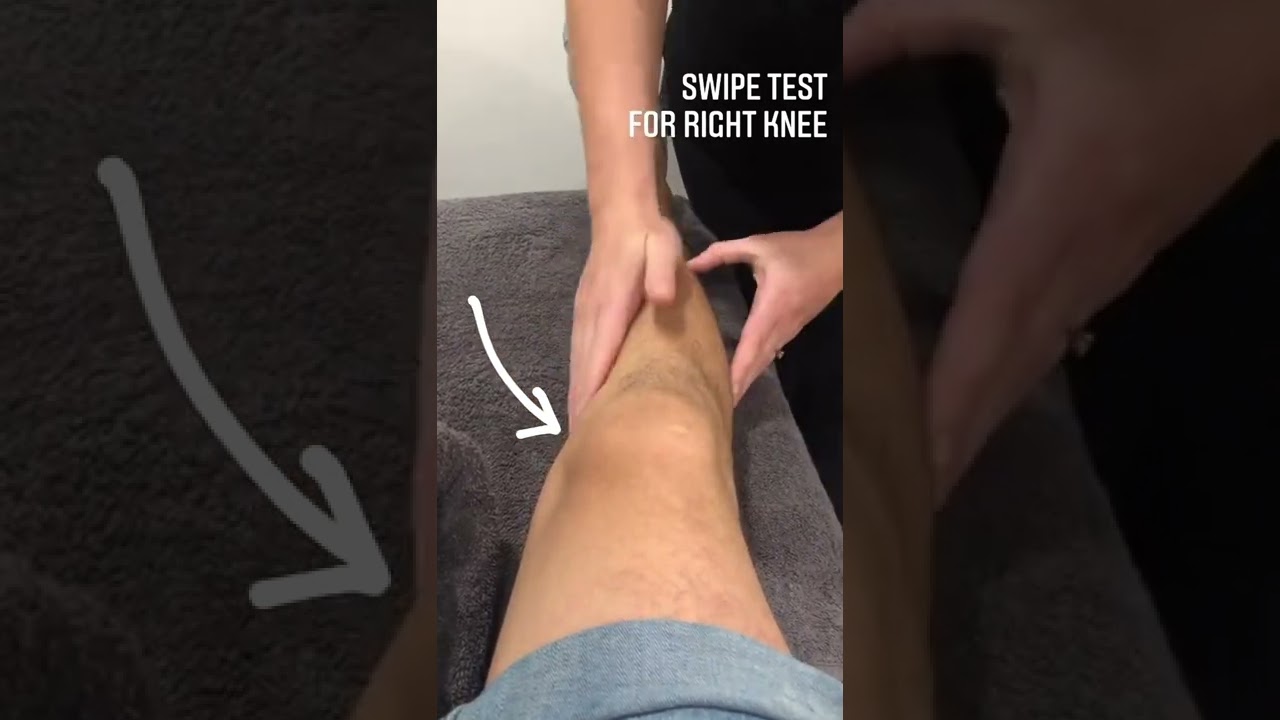 This test is used in the clinic to assess for a knee effusion, or swelling in the knee joint