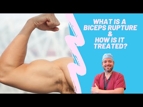 What is a biceps rupture and how is it treated?