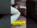 Quick Home Solution For Broken Tooth Shorts