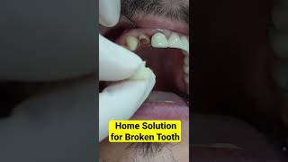 Quick Home Solution for Broken Tooth #shorts