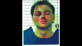 Police Brutality Worse than Rodney King - The Robert Leone Story