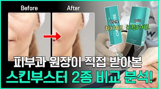 요즘 핫한 스킨바이브, 리바이브 제 얼굴에 반반 직접 받아봤습니다! | 200% 솔직 리뷰