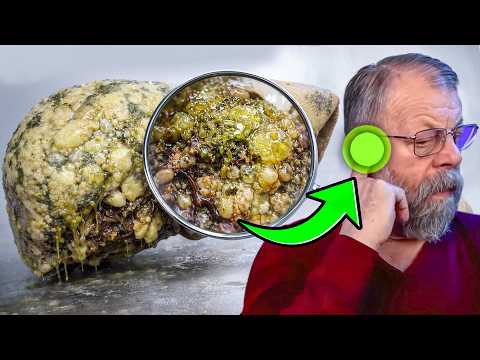 УЧЕНЫЕ в ШОКЕ! Найден способ БЫСТРО очистить ПЕЧЕНЬ, 99% людей не знают этого