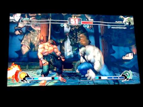 AlboShinobi (Ryu) Vs SoMuchDamage (Zangief)