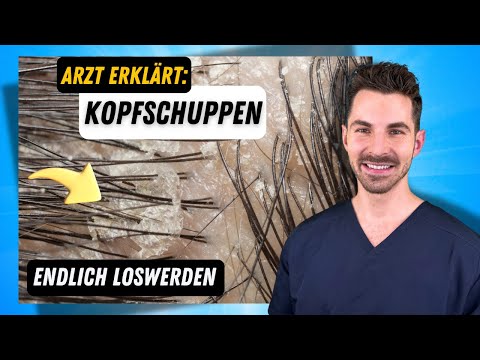 Die Ursache Nr. 1 für Kopfschuppen & wie du sie loswirst in 2024 (Arzt erklärt)