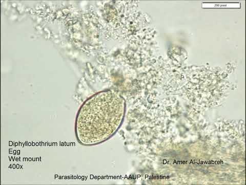 diphyllobothriasis kockázati tényezők tüdő férgek hogyan kell kezelni