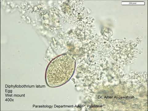 a diphyllobothriasis kezelése felnőtteknél