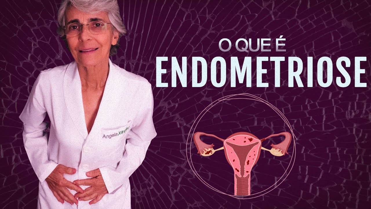ENDOMETRIOSE, o que é e o que fazer?