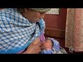 Not Enough Milk Burmese Breastfeeding Series