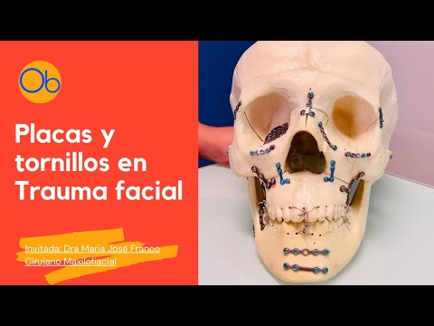 Placas y tornillos en Trauma Facial