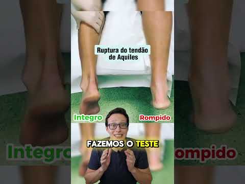 Ruptura do Tendão de Aquiles😱🦵  #medico #medicina #curiosidades #curiosidademedicina  #enfermeira
