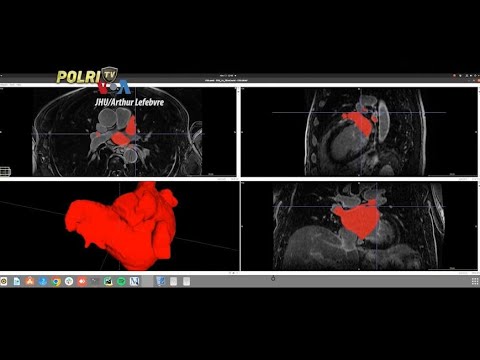 MANFAATKAN AI UNTUK SKRINING PENYAKIT JANTUNG DAN KANKER