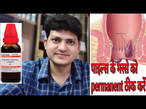To eliminate piles warts Homeopathic medicine?permanent theek hone ke liye?