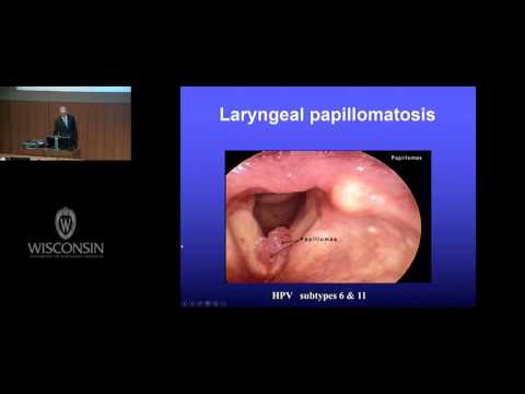 Nasal papilloma pathology