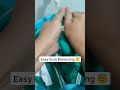 How to Remove Chewing Gum from Clothes