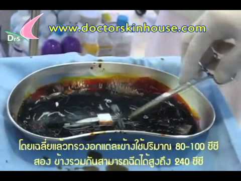 รุ่นหน้าอกพลาสติก เขาจบระหว่างหน้าอกเล็ก