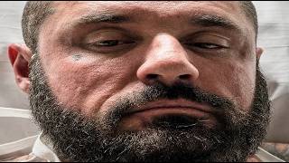 A Decade of Steroid Use Left Him With This - Mark Carroll