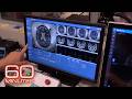 Medical Breakthroughs And Health Stories 60 Minutes Marathon
