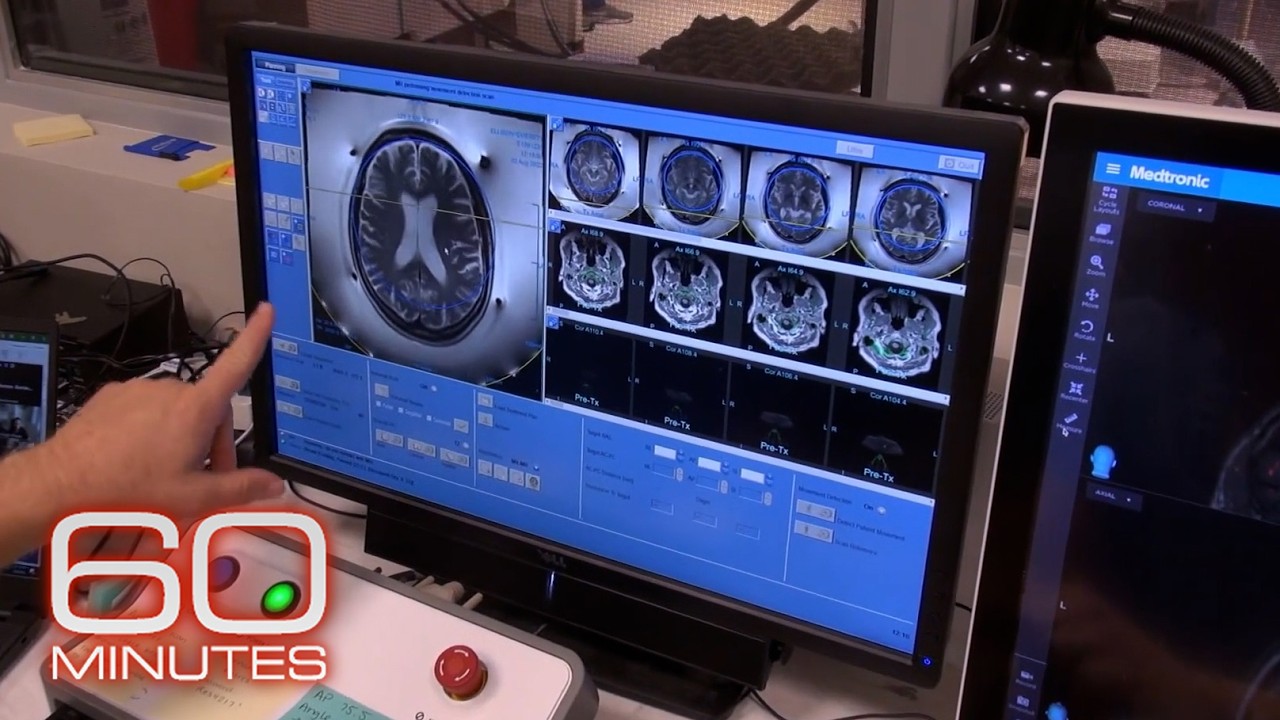 Medical breakthroughs and health stories | 60 Minutes Marathon