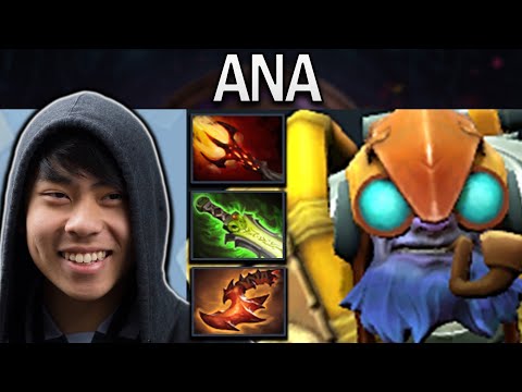 Tinker Dota 2 Gameplay Ana with 24 Kills - Shivas