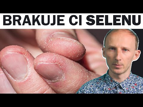 8 oznak, że powinieneś jeść więcej selenu