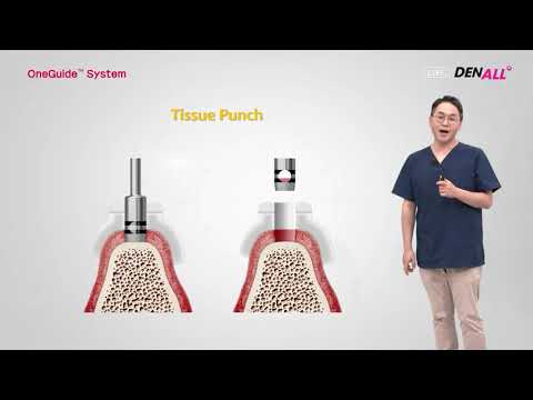 OneGuide (ep.2 OneGuide System Understanding and Clinical Applica)