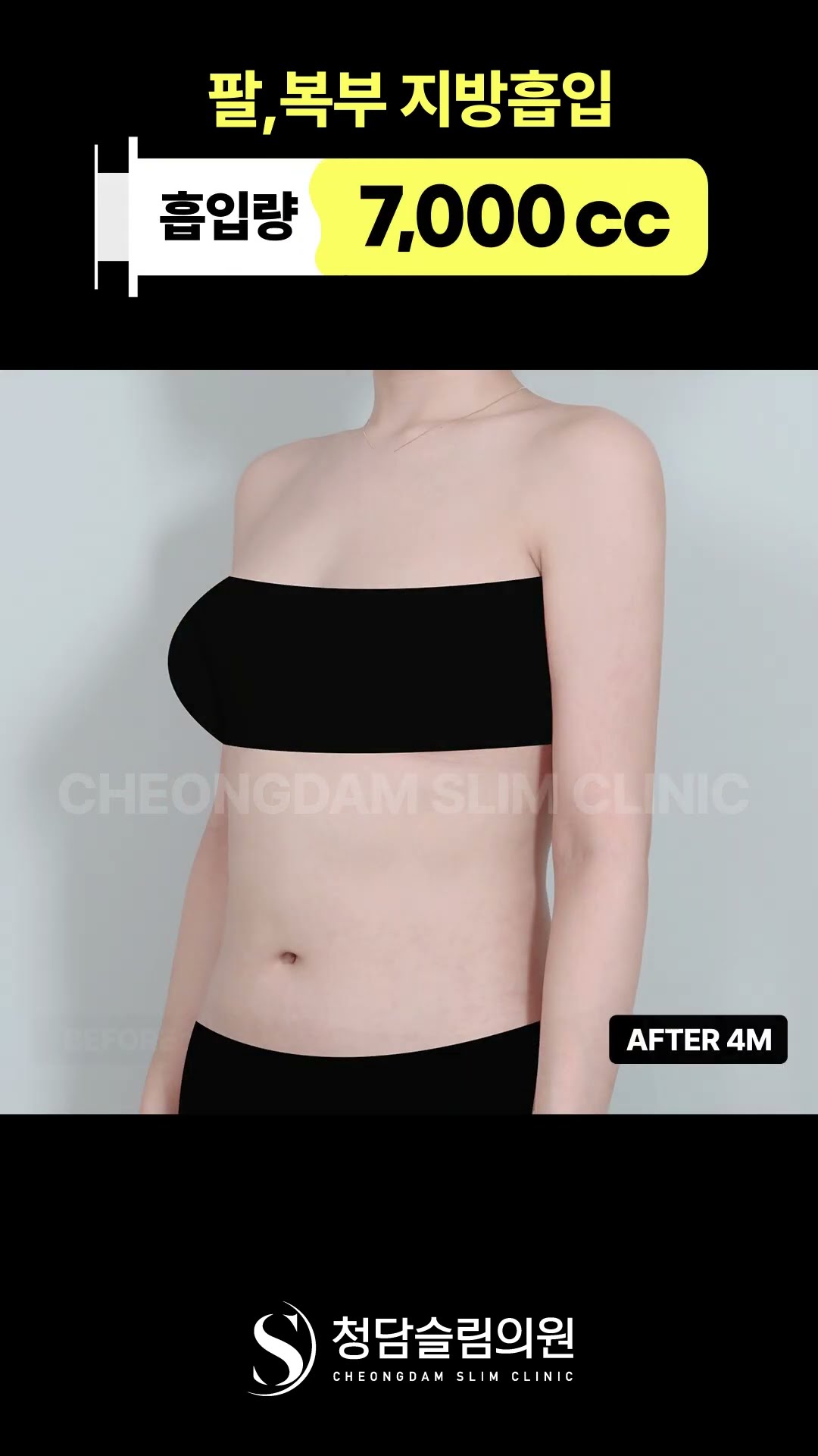 상체 핏 좋아 보이는 이유 👆