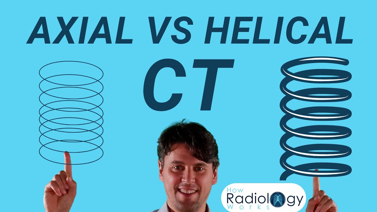 CT Scan Modes Compared (Axial vs Helical)