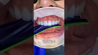 Por que os dentistas usam essa fita? 🤔 #curiosidades #fatoscuriosos #shorts