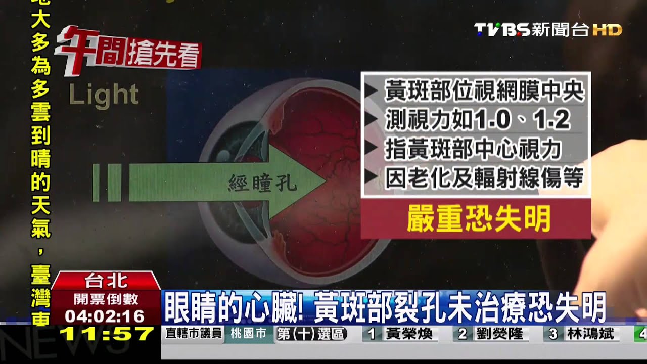 ​用眼過度　媽媽嘴命案法官黃斑部裂孔