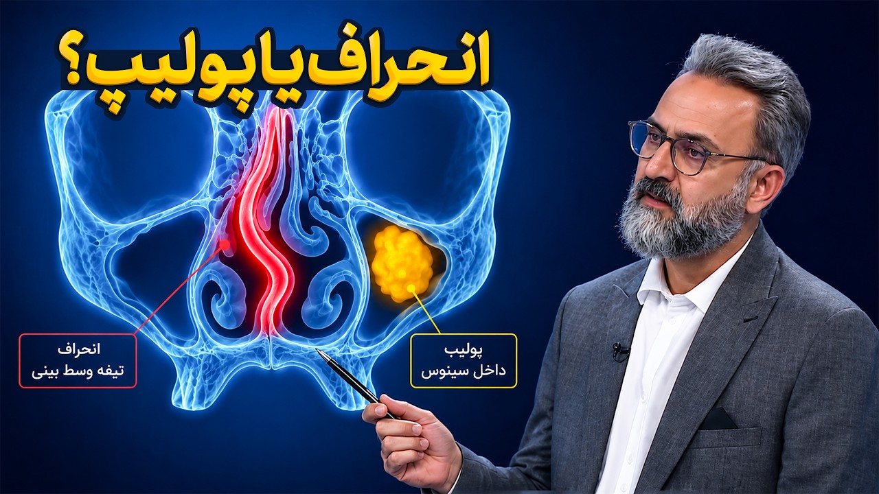 تفاوت پولیپ و انحراف بینی چیست؟ / کی باید عمل کنیم؟