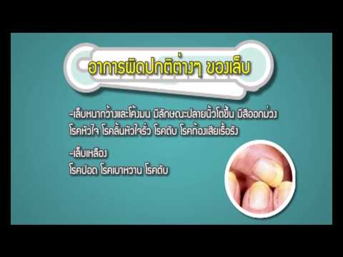 เล็บบอกโรค