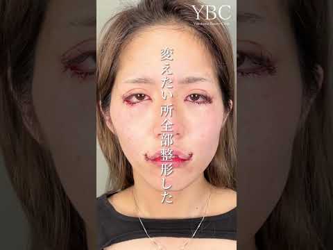 犬の耳の傷の原因と治療法