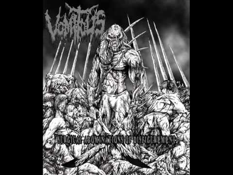 Vomitous - Surgical Abomination Of Disfigurement (Vocal Cover)