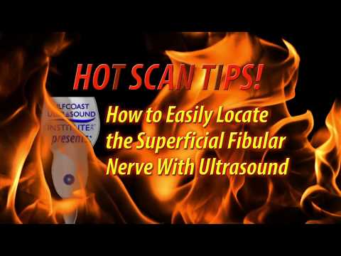 Hot Tip-How to Easily Locate the Superficial Fibular Nerve with Ultrasound