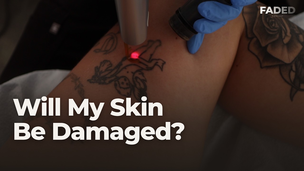Laser Tattoo Removal Before and After: Real Results