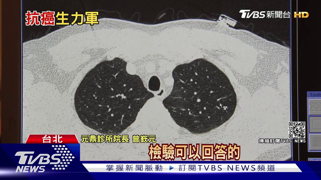 醫療日新月異!基因檢測、免疫療法、創新手術問世 癌友福音