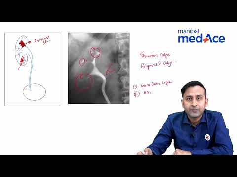 Imaging GU Infections: Radiology Lecture by Dr. Abhishek Jha | Manipal MedAce