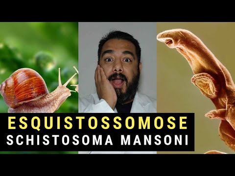Schistosomiasis or Water Belly (Schistosoma mansoni): Human Parasitology Course