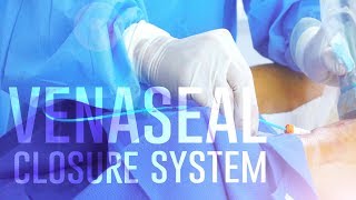 VenaSeal Closure System | Vein Care | Vein Treatment Center