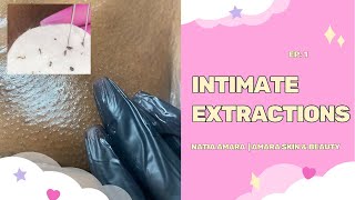 THIGH EXTRACTIONS | My FIRST Video!