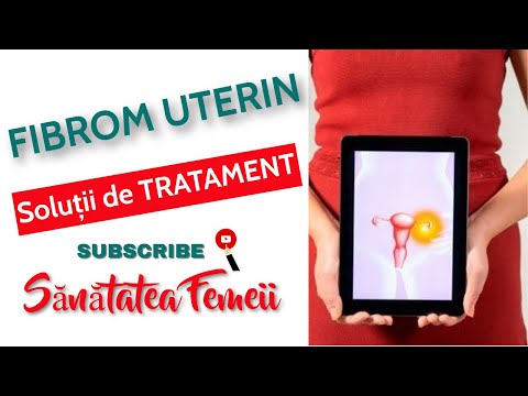 FIBROMUL UTERIN. Cum se poate TRATA
