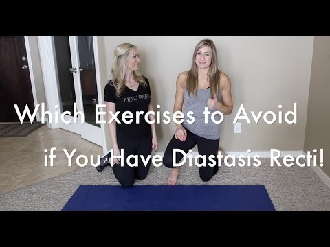 Exercises to AVOID if You Have Diastasis Recti (Including Crunches!)