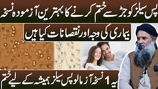 Pus Cell Ka Ilaj | Pus Cell Treatment In Urdu | Pus Cell Khatam Karne Ka Desi Nuskha Dr Sharafat Ali