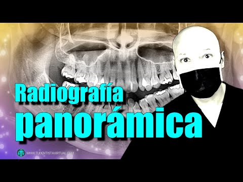 Que vemos en una RADIOGRAFÍA PANORÁMICA