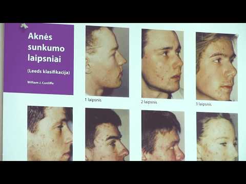 sukrėsti sx 7 svorio netekimas
