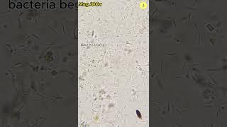 Does hand sanitizer kill 100% of bacteria | TULO - Microscope  #shorts #bacteria #hand