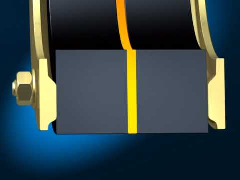 DOYMA Curaflex® - DPS - Double Profile System