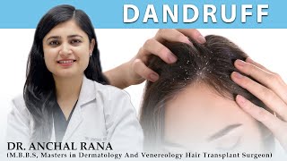 Dandruff || What causes dandruff, and how do you get rid of it? || Tips to get rid of Dandruff