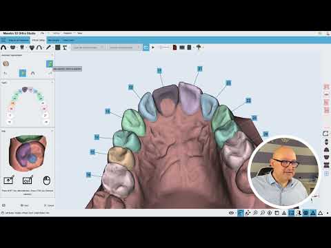 Automatic segmentation